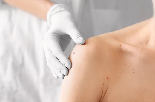 Gornji deo tela (leva polovina) ženskog pacijenta ilustruje pregled dermatologa kada se radi o najčešćim promenama na koži, kao i mladežima. U fokusu je nekoliko mladeža koji su čest razloga pacijenata dermatologu