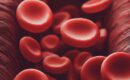 Anemia