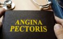 Angina pektoris