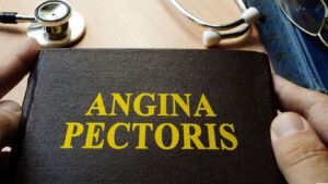 Angina pektoris