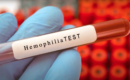 Hemofilija test