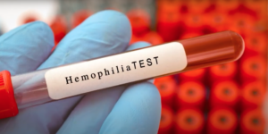 Hemofilija test